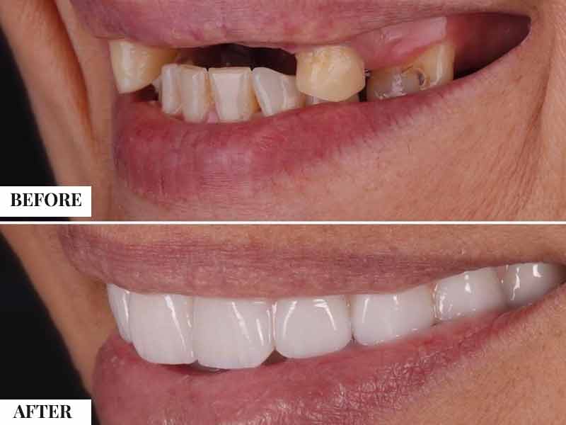 Response time standards