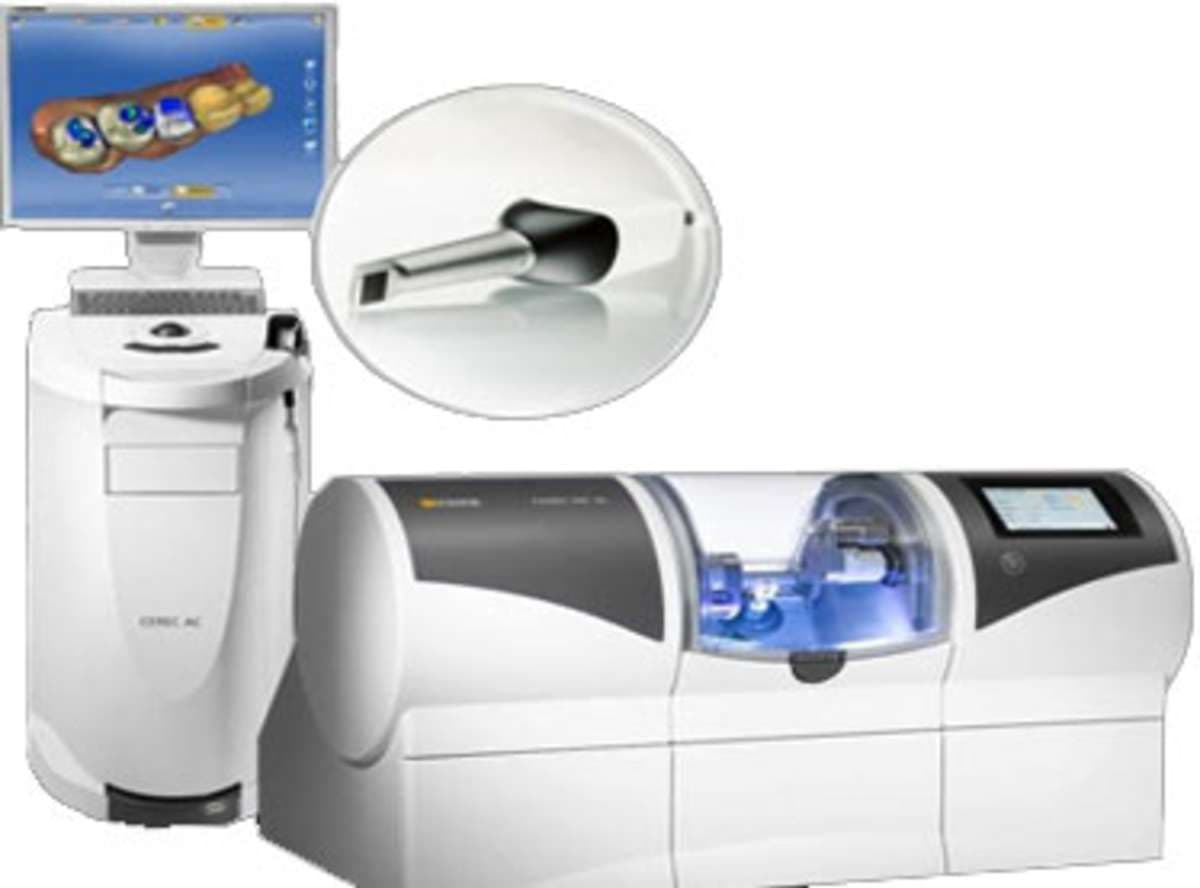 CEREC same-day restorations
