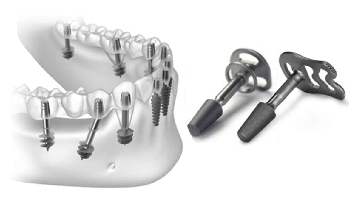 Step-by-Step: Basal Implants at Stunning Dentistry <!-- viewport: condense tablet -->
