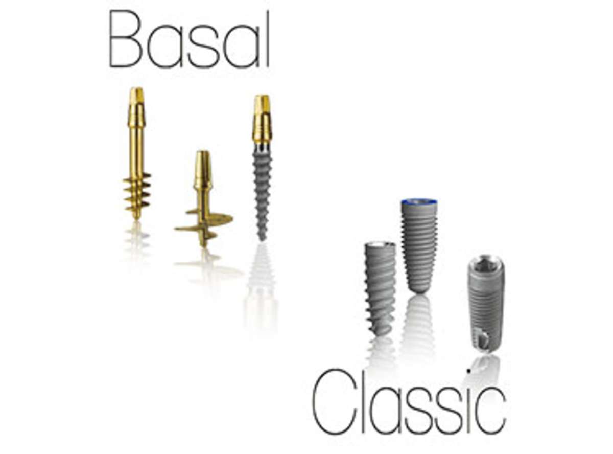 What Are Basal Implants? <!-- viewport: condense tablet -->