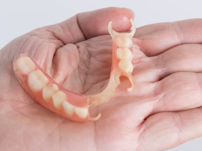 When Overdentures Are NOT the Right Choice <!-- viewport: condense tablet -->